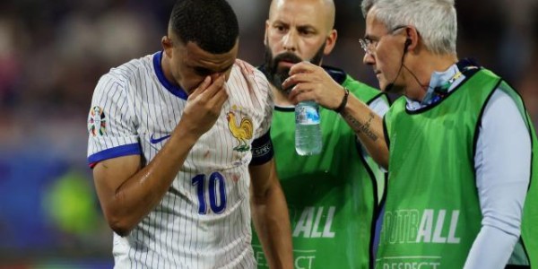 开云app-姆巴佩鼻骨骨折但暂无需手术 或缺席2场小组赛